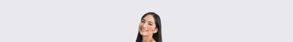 Jerawat