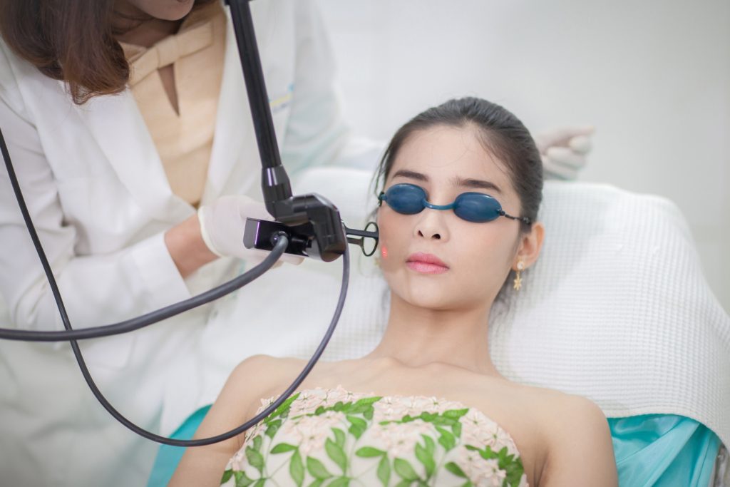 laser acne