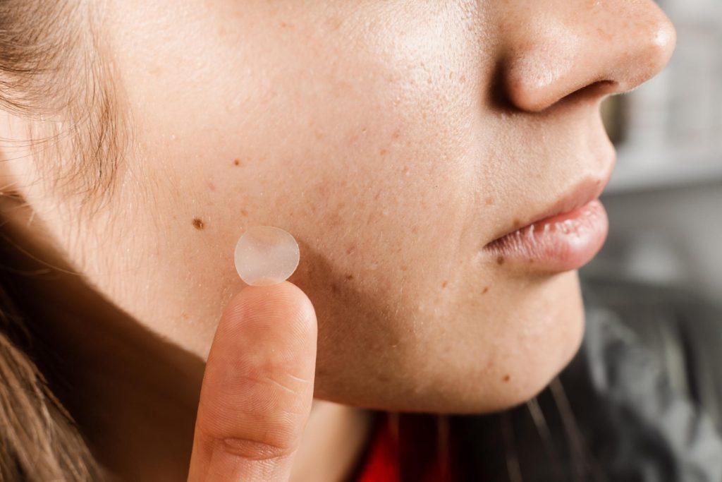 acne patch