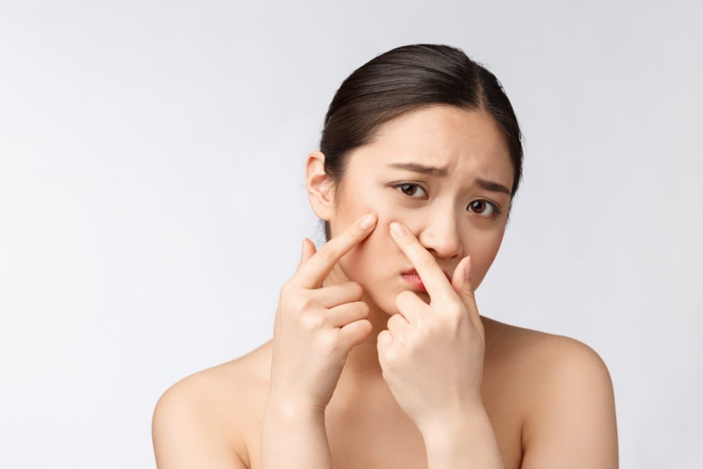 jerawat hormonal