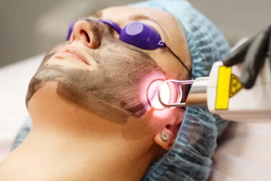 Pico Laser